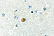 AP01444PU-N - IRF3