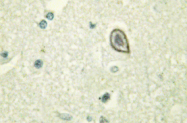 AP01445PU-N - CD115