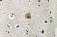 AP01446PU-N - MAP2K1