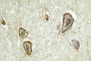 AP01451PU-N - Rhodopsin kinase