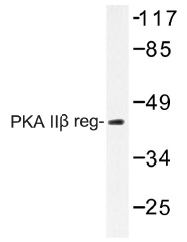 AP01453PU-N - PRKAR2B