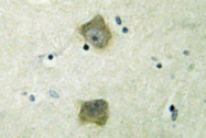 AP01458PU-N - CDK5