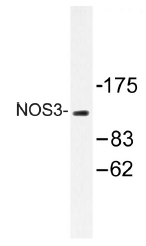 AP01459PU-N - NOS3