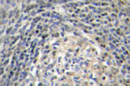 AP01461PU-N - NCF1