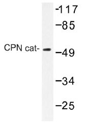 AP01465PU-N - Carboxypeptidase N catalytic chain