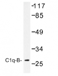 AP01469PU-N - C1q B subunit
