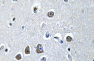 AP01470PU-N - EIF3E / EIF3S6