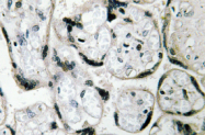 AP01486PU-N - CYB5R3
