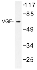 AP01489PU-N - VGF