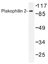 AP01493PU-N - Plakophilin-2