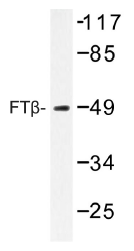 AP01497PU-N - FNTB