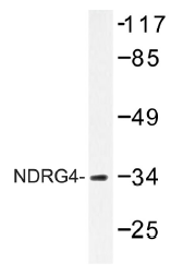 AP01498PU-N - NDRG4