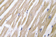 AP01498PU-N - NDRG4