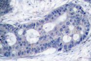 AP01512PU-N - EIF4E