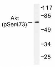 AP01520PU-N - AKT1 / PKB