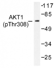 AP01522PU-N - AKT1 / PKB