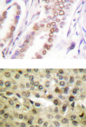 AP01524PU-N - Androgen receptor