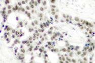 AP01525PU-N - Androgen receptor