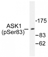 AP01526PU-N - MEKK5 / ASK1