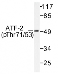 AP01531PU-N - ATF2