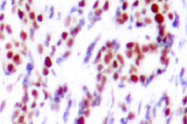 AP01531PU-N - ATF2