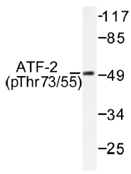 AP01532PU-N - ATF2