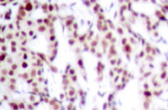 AP01532PU-N - ATF2
