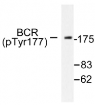 AP01539PU-N - BCR