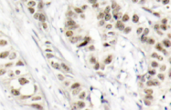 AP01540PU-N - BRCA1 / RNF53