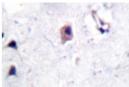 AP01726PU-N - Amyloid beta A4 protein / APP