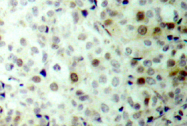 AP01546PU-N - CDK1