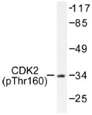 AP01550PU-N - CDK2