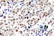 AP01554PU-N - CHK1