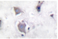 AP01712PU-N - TrkB