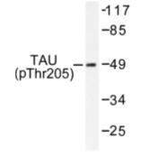 AP01710PU-N - MAPT / TAU