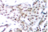 AP01710PU-N - MAPT / TAU