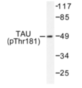 AP01709PU-N - MAPT / TAU