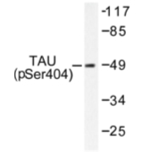 AP01708PU-N - MAPT / TAU