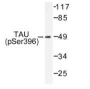 AP01707PU-N - MAPT / TAU