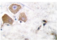 AP01707PU-N - MAPT / TAU