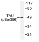 AP01706PU-N - MAPT / TAU