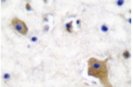 AP01706PU-N - MAPT / TAU