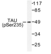 AP01704PU-N - MAPT / TAU