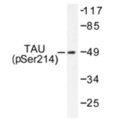 AP01703PU-N - MAPT / TAU