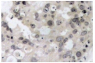 AP01703PU-N - MAPT / TAU