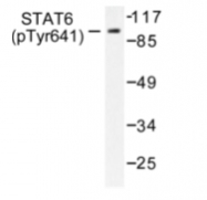 AP01698PU-N - STAT6