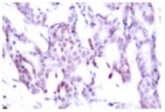 AP01697PU-N - STAT6