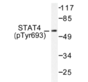 AP01694PU-N - STAT4