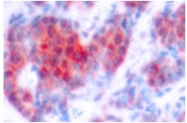 AP01694PU-N - STAT4