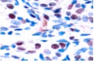 AP01692PU-N - STAT3